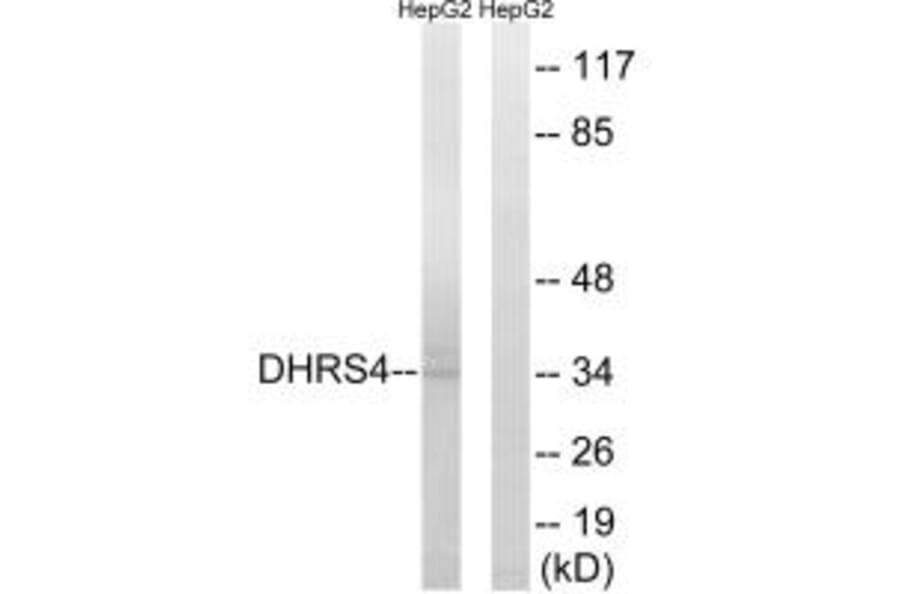 Western blot - DHRS4 Antibody from Signalway Antibody (34644) - Antibodies.com