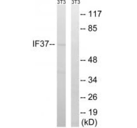 Western blot - EIF3D Antibody from Signalway Antibody (34681) - Antibodies.com