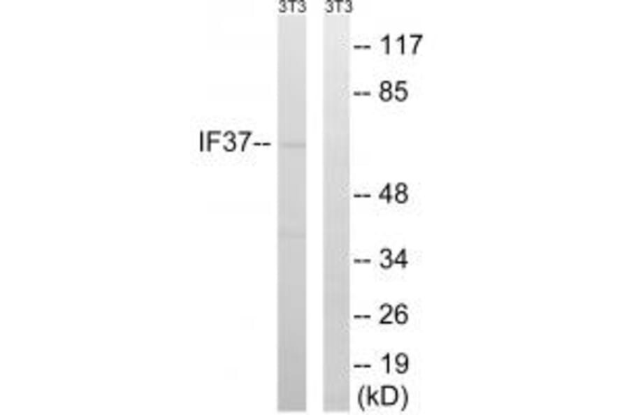 Western blot - EIF3D Antibody from Signalway Antibody (34681) - Antibodies.com