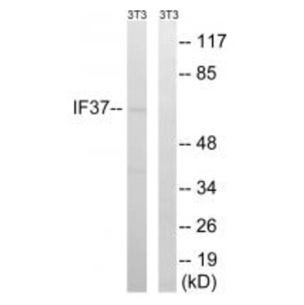 Western blot - EIF3D Antibody from Signalway Antibody (34681) - Antibodies.com