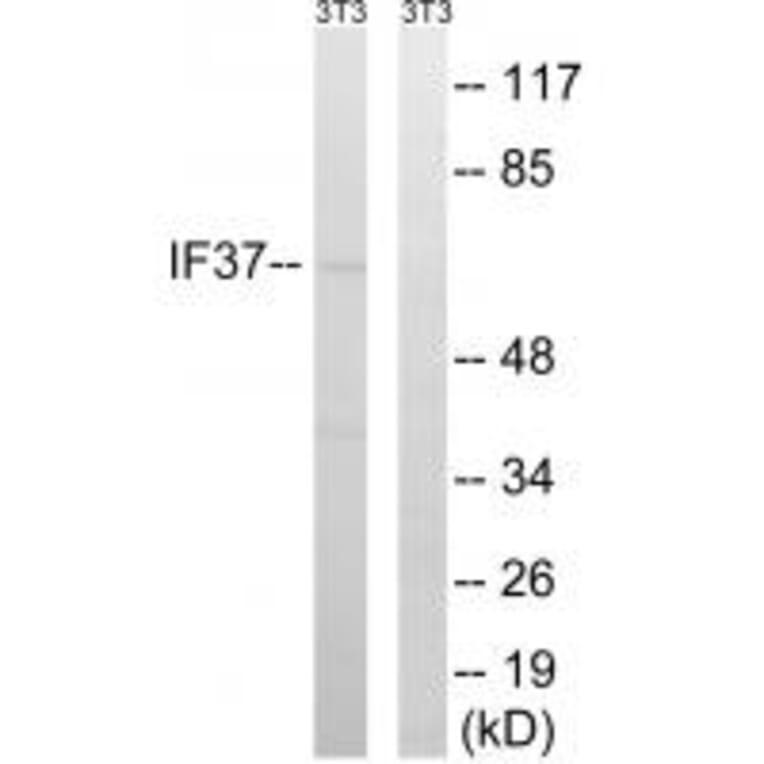 Western blot - EIF3D Antibody from Signalway Antibody (34681) - Antibodies.com