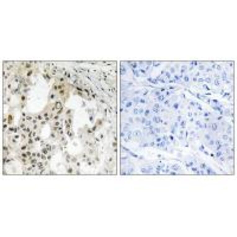 Immunohistochemistry - EIF3D Antibody from Signalway Antibody (34681) - Antibodies.com