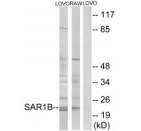 Western blot - SAR1B Antibody from Signalway Antibody (34724) - Antibodies.com