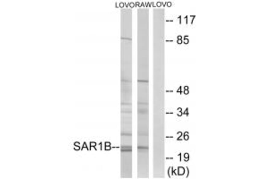 Western blot - SAR1B Antibody from Signalway Antibody (34724) - Antibodies.com
