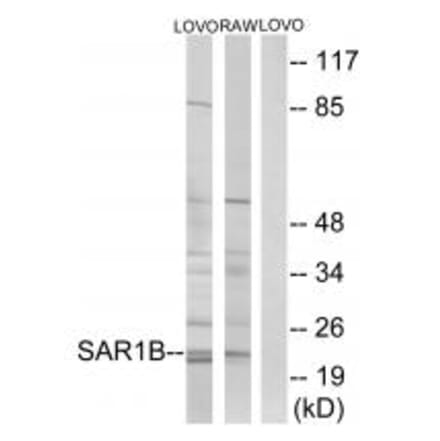 Western blot - SAR1B Antibody from Signalway Antibody (34724) - Antibodies.com