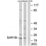 Western blot - SAR1B Antibody from Signalway Antibody (34724) - Antibodies.com