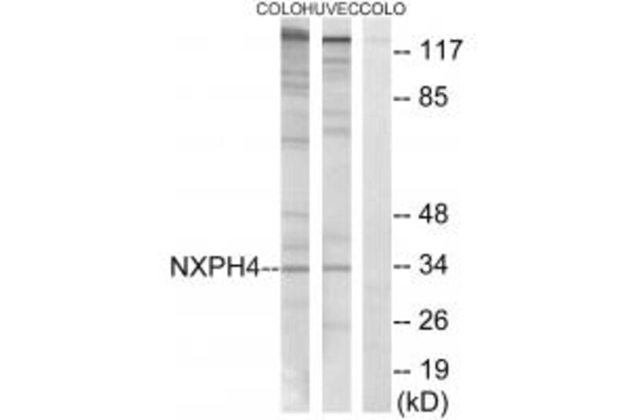 Western blot - NXPH4 Antibody from Signalway Antibody (34852) - Antibodies.com