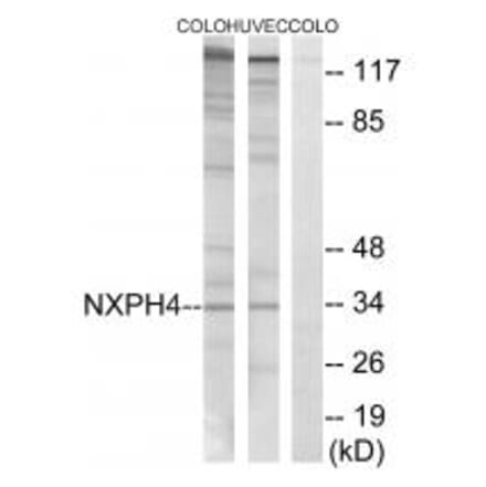 Western blot - NXPH4 Antibody from Signalway Antibody (34852) - Antibodies.com