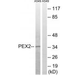 Western blot - PXMP3 Antibody from Signalway Antibody (34896) - Antibodies.com