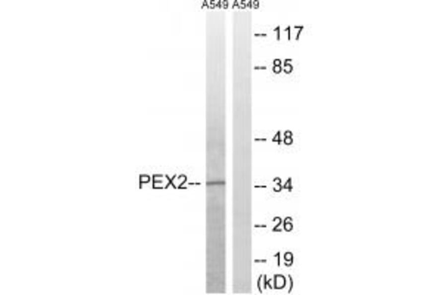 Western blot - PXMP3 Antibody from Signalway Antibody (34896) - Antibodies.com