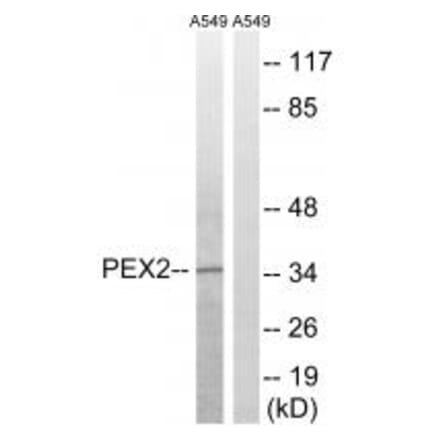 Western blot - PXMP3 Antibody from Signalway Antibody (34896) - Antibodies.com