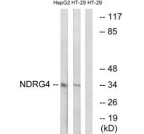 Western blot - NDRG4 Antibody from Signalway Antibody (34930) - Antibodies.com