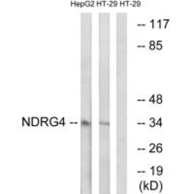 Western blot - NDRG4 Antibody from Signalway Antibody (34930) - Antibodies.com