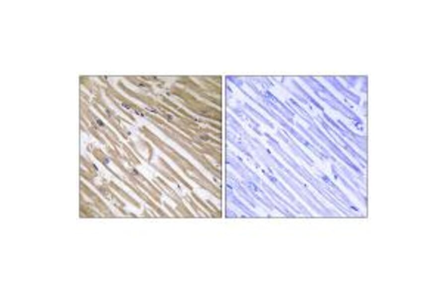 Immunohistochemistry - NDRG4 Antibody from Signalway Antibody (34930) - Antibodies.com