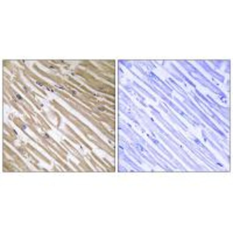 Immunohistochemistry - NDRG4 Antibody from Signalway Antibody (34930) - Antibodies.com