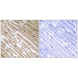 Immunohistochemistry - NDRG4 Antibody from Signalway Antibody (34930) - Antibodies.com