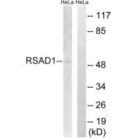 Western blot analysis of extracts from HeLa cells, using RSAD1 antibody #34954.