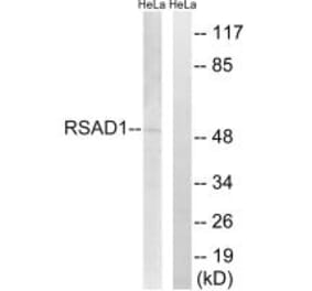 Western blot - RSAD1 Antibody from Signalway Antibody (34954) - Antibodies.com