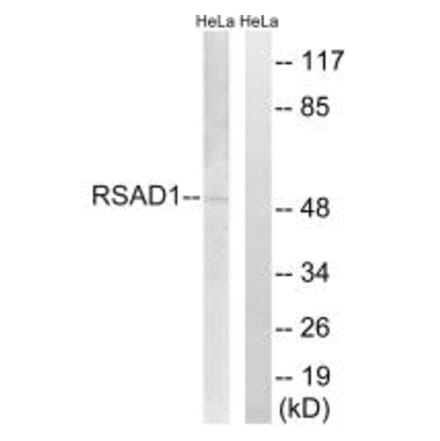 Western blot - RSAD1 Antibody from Signalway Antibody (34954) - Antibodies.com