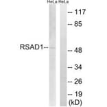 Western blot - RSAD1 Antibody from Signalway Antibody (34954) - Antibodies.com