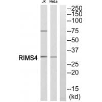 Western blot analysis of extracts from JK cells and Hela cells, using RIMS4 antibody #34978.