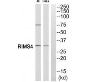 Western blot - RIMS4 Antibody from Signalway Antibody (34978) - Antibodies.com