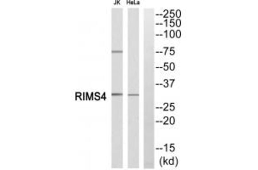 Western blot - RIMS4 Antibody from Signalway Antibody (34978) - Antibodies.com