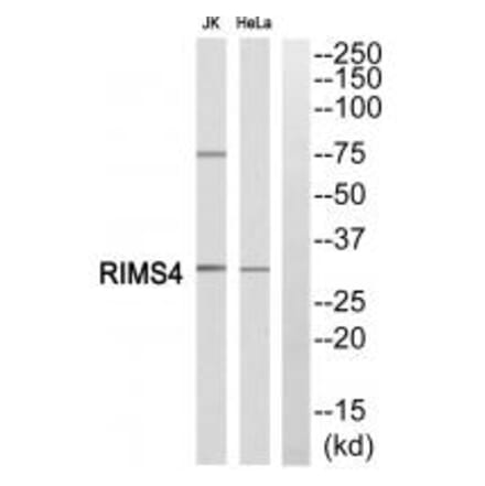 Western blot - RIMS4 Antibody from Signalway Antibody (34978) - Antibodies.com