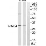 Western blot - RIMS4 Antibody from Signalway Antibody (34978) - Antibodies.com