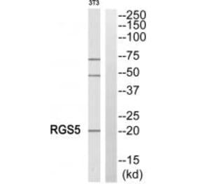 Western blot - RGS5 Antibody from Signalway Antibody (34983) - Antibodies.com