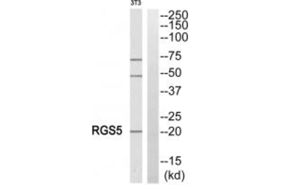 Western blot - RGS5 Antibody from Signalway Antibody (34983) - Antibodies.com