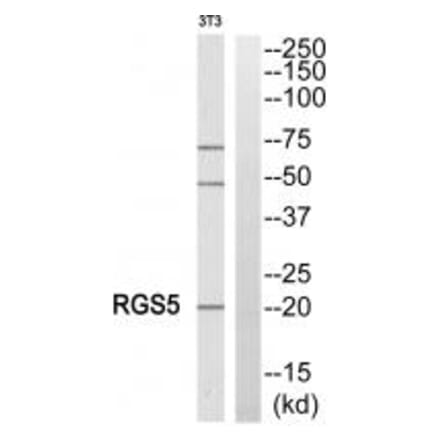 Western blot - RGS5 Antibody from Signalway Antibody (34983) - Antibodies.com