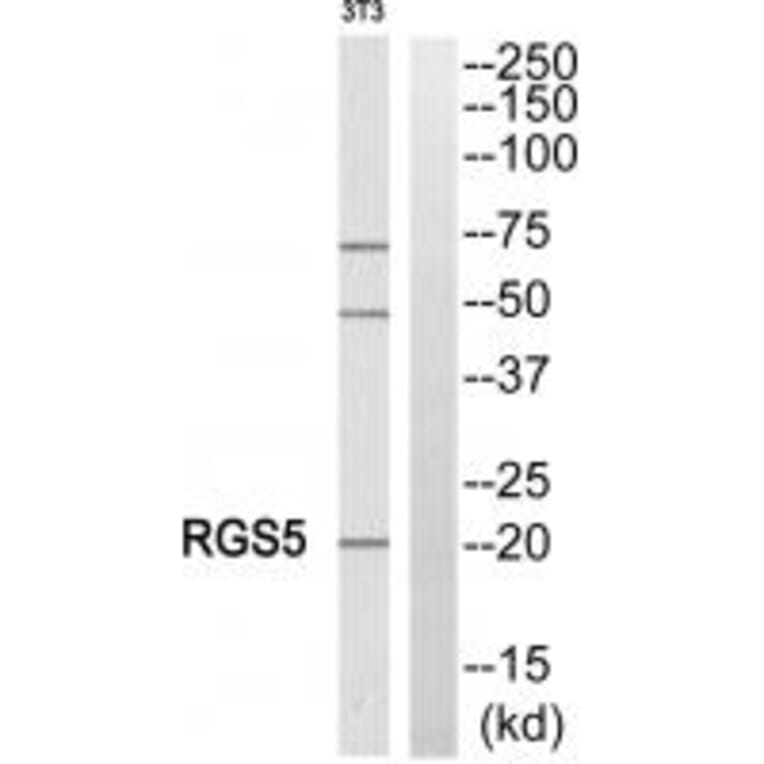 Western blot - RGS5 Antibody from Signalway Antibody (34983) - Antibodies.com
