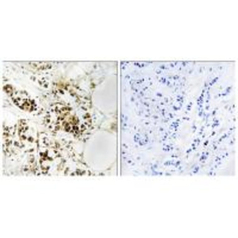 Immunohistochemistry - RGS5 Antibody from Signalway Antibody (34983) - Antibodies.com