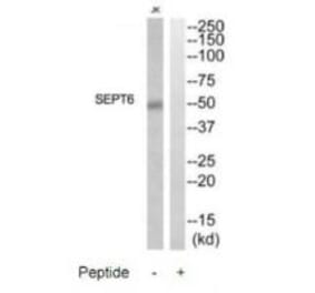 Western blot - SEPT6 Antibody from Signalway Antibody (35015) - Antibodies.com