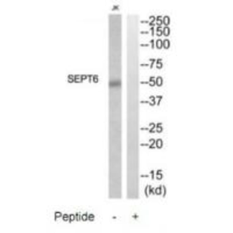 Western blot - SEPT6 Antibody from Signalway Antibody (35015) - Antibodies.com