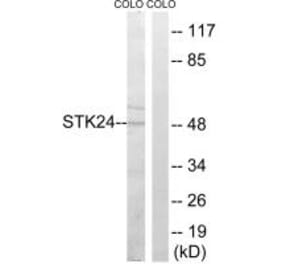 Western blot - STK24 Antibody from Signalway Antibody (35019) - Antibodies.com