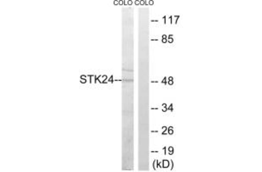 Western blot - STK24 Antibody from Signalway Antibody (35019) - Antibodies.com