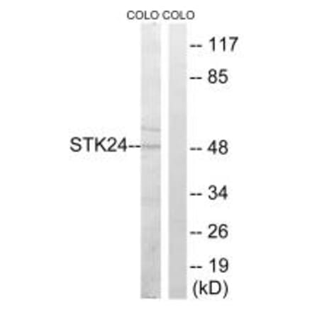 Western blot - STK24 Antibody from Signalway Antibody (35019) - Antibodies.com