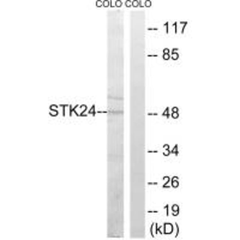 Western blot - STK24 Antibody from Signalway Antibody (35019) - Antibodies.com