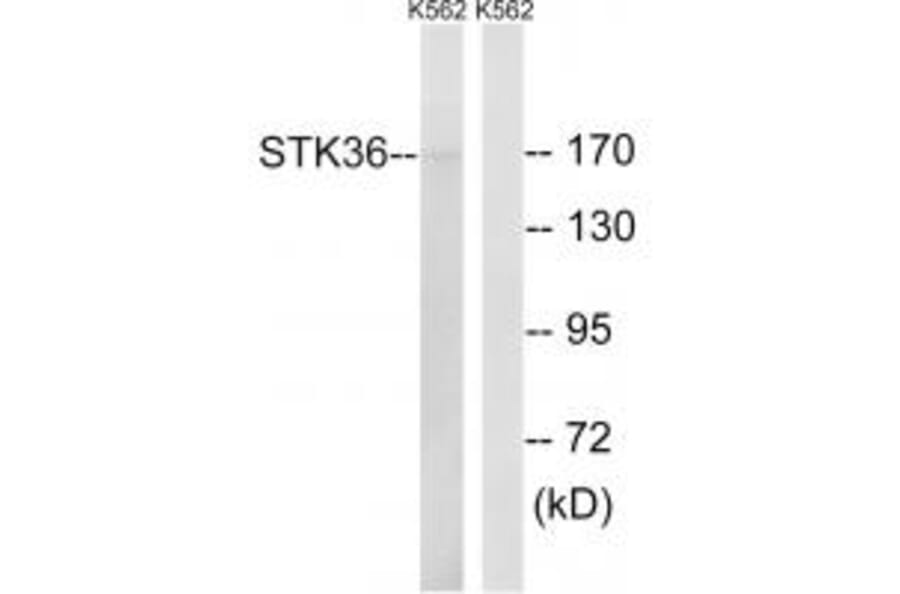 Western blot - STK36 Antibody from Signalway Antibody (35020) - Antibodies.com