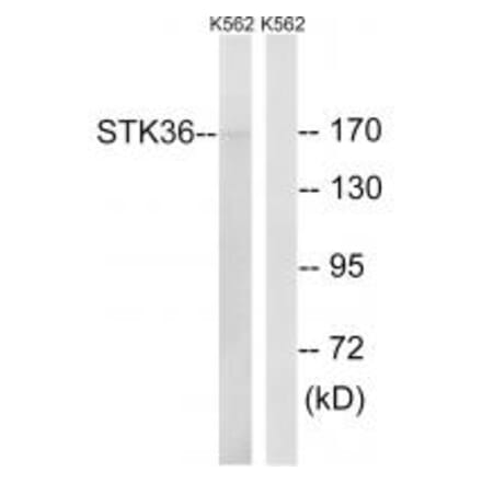 Western blot - STK36 Antibody from Signalway Antibody (35020) - Antibodies.com