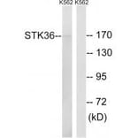 Western blot - STK36 Antibody from Signalway Antibody (35020) - Antibodies.com
