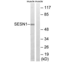 Western blot - SESN1 Antibody from Signalway Antibody (35038) - Antibodies.com