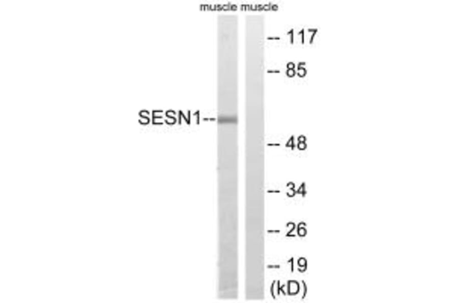 Western blot - SESN1 Antibody from Signalway Antibody (35038) - Antibodies.com