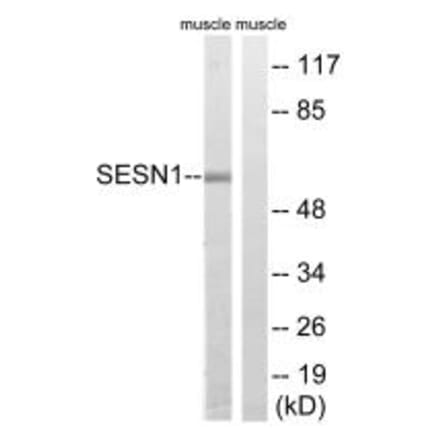 Western blot - SESN1 Antibody from Signalway Antibody (35038) - Antibodies.com
