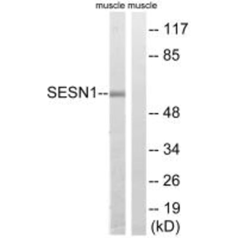 Western blot - SESN1 Antibody from Signalway Antibody (35038) - Antibodies.com