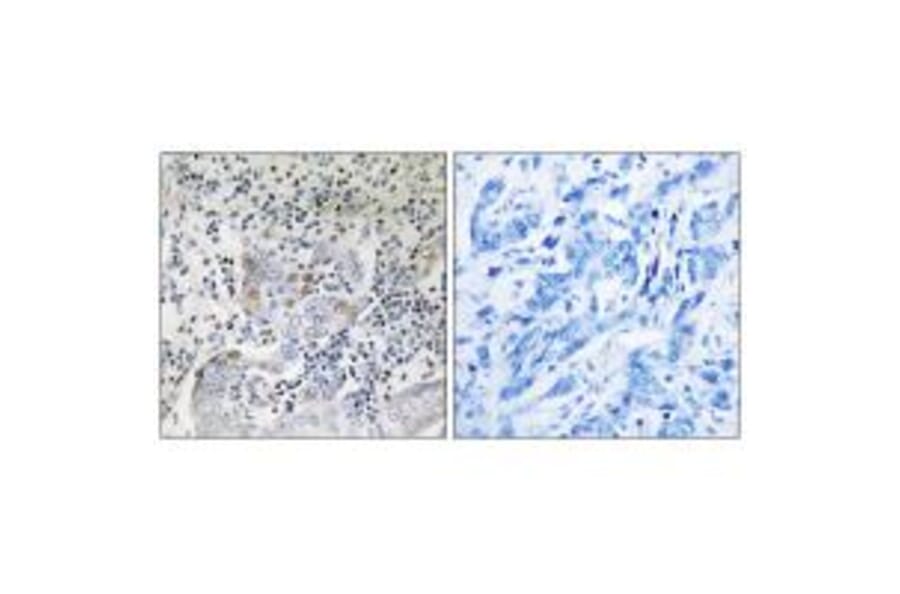 Immunohistochemistry - SESN1 Antibody from Signalway Antibody (35038) - Antibodies.com