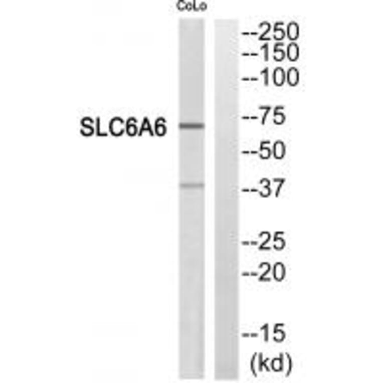 Western blot - SC6A6 Antibody from Signalway Antibody (35051) - Antibodies.com