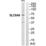 Western blot - SC6A6 Antibody from Signalway Antibody (35051) - Antibodies.com